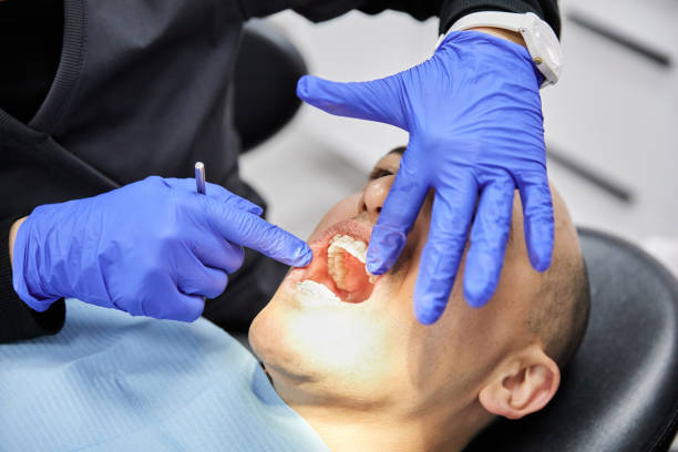Best Dentist for Dental Trauma  in Oceanside, CA